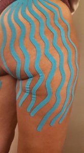 linfotaping-cellulite