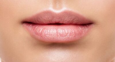 Il Filler Labbra: cosa aspettarsi dopo aver fatto il trattamento
